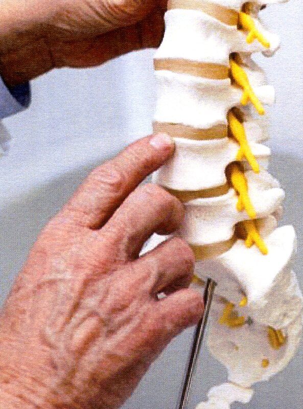Picture of spine model