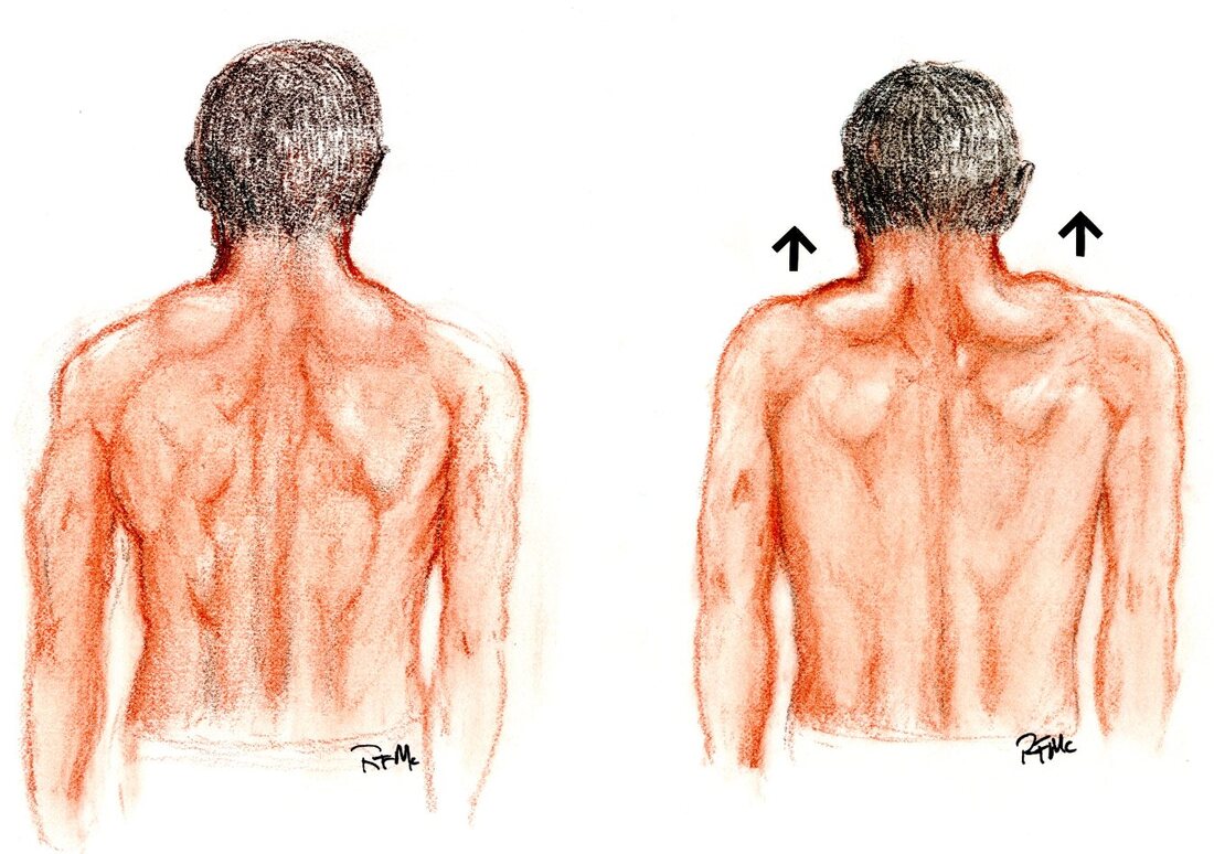 Neck physical therapy includes shoulder shrugs and shoulder girdle strengthening.