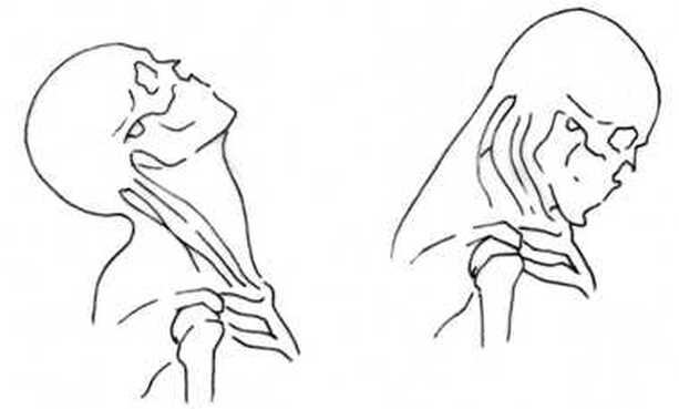 Head and Neck Movements
