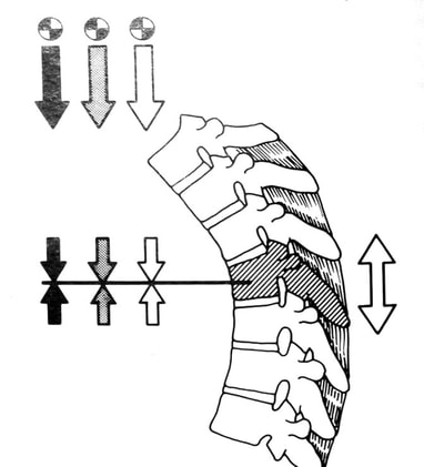 Diagram showing the forces that are applied to an injured vertebra during daily activities