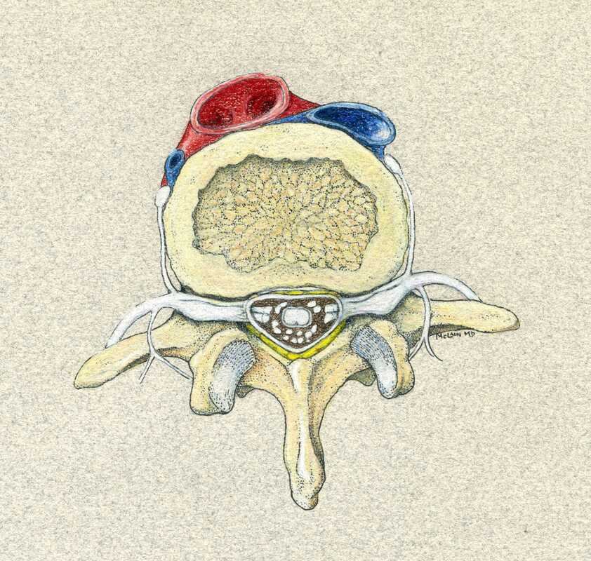 Back pain relief and neck pain relief depend on a careful and complete description of the patient's symptoms.  Illustration of the lumbar spinal anatomy.  (McLain 2002).
