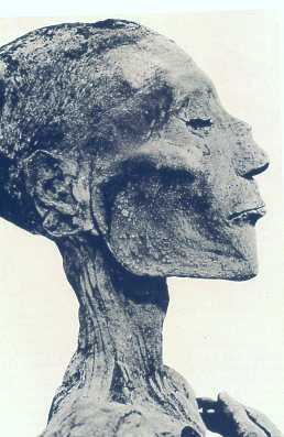 Picture of Pharaoh with small pox scars