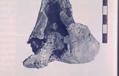 Picture of eroded and possibly infected femur Shanidar 1.